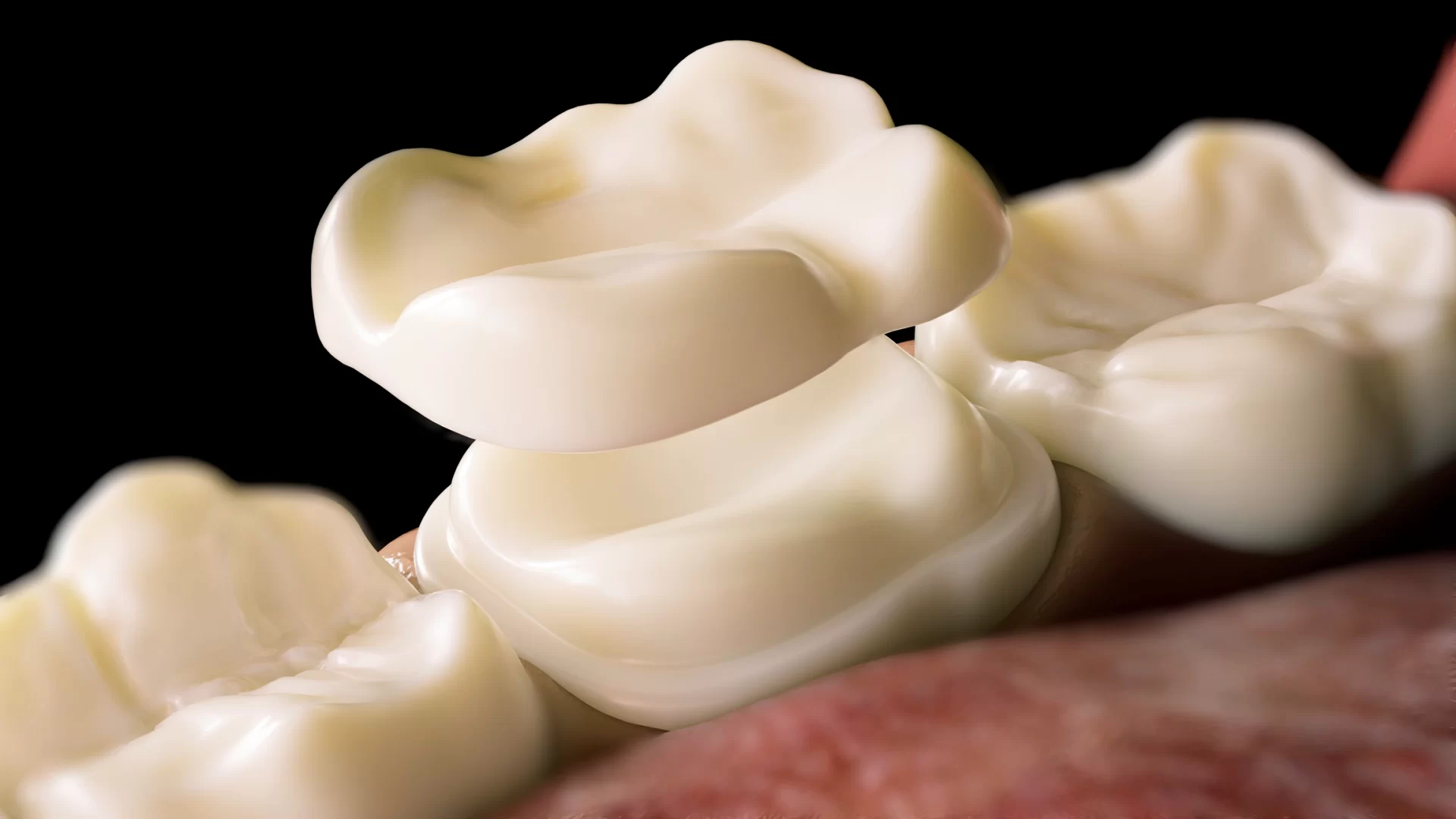 close up of dental crowns concept