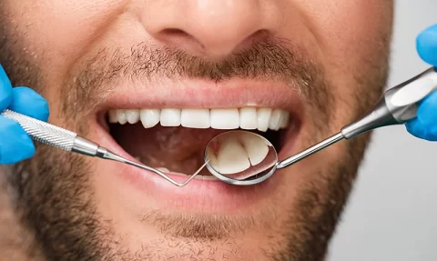 close up of dentist tools in patient's mouth