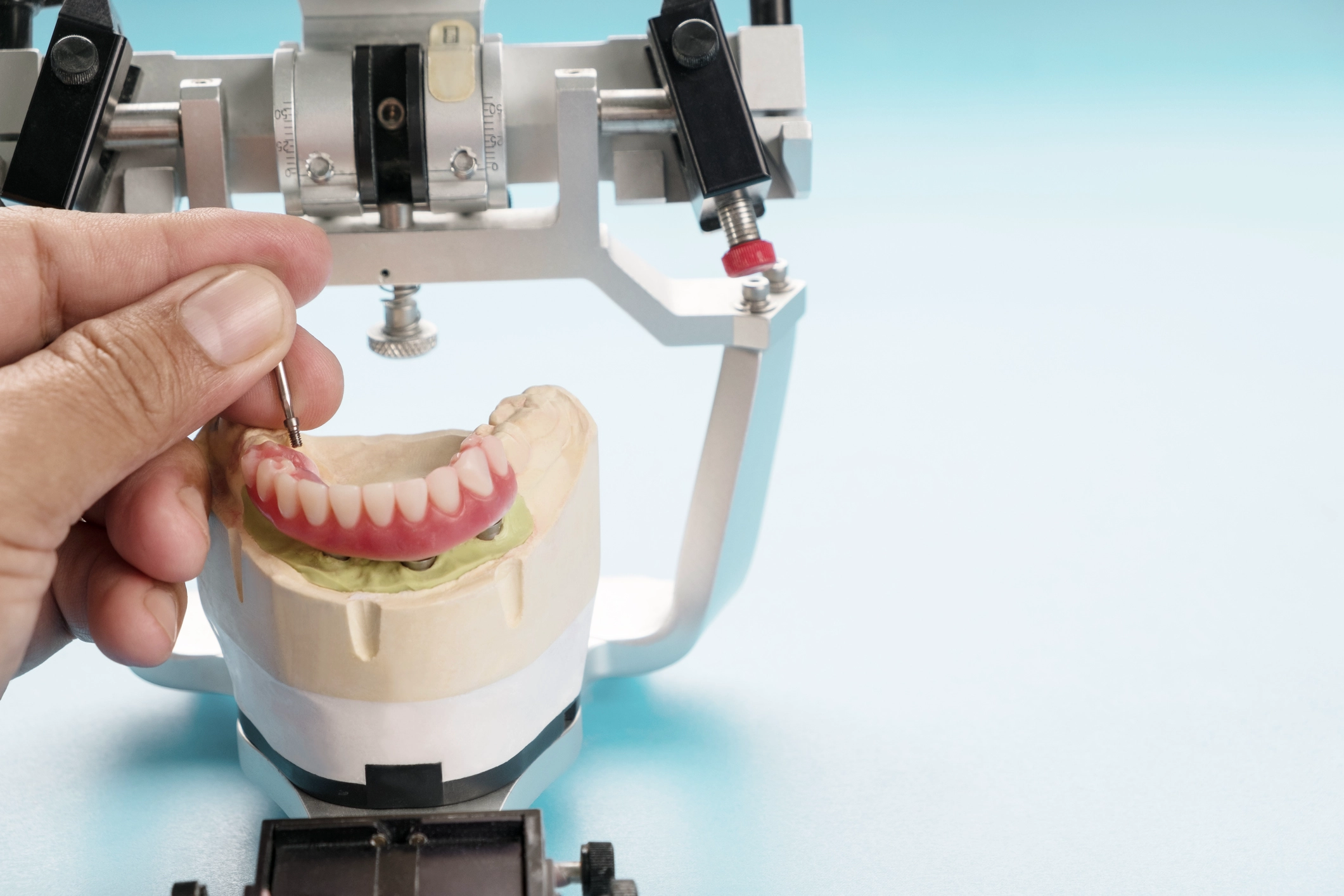 Dental veneers in Fort Lauderdale, FL