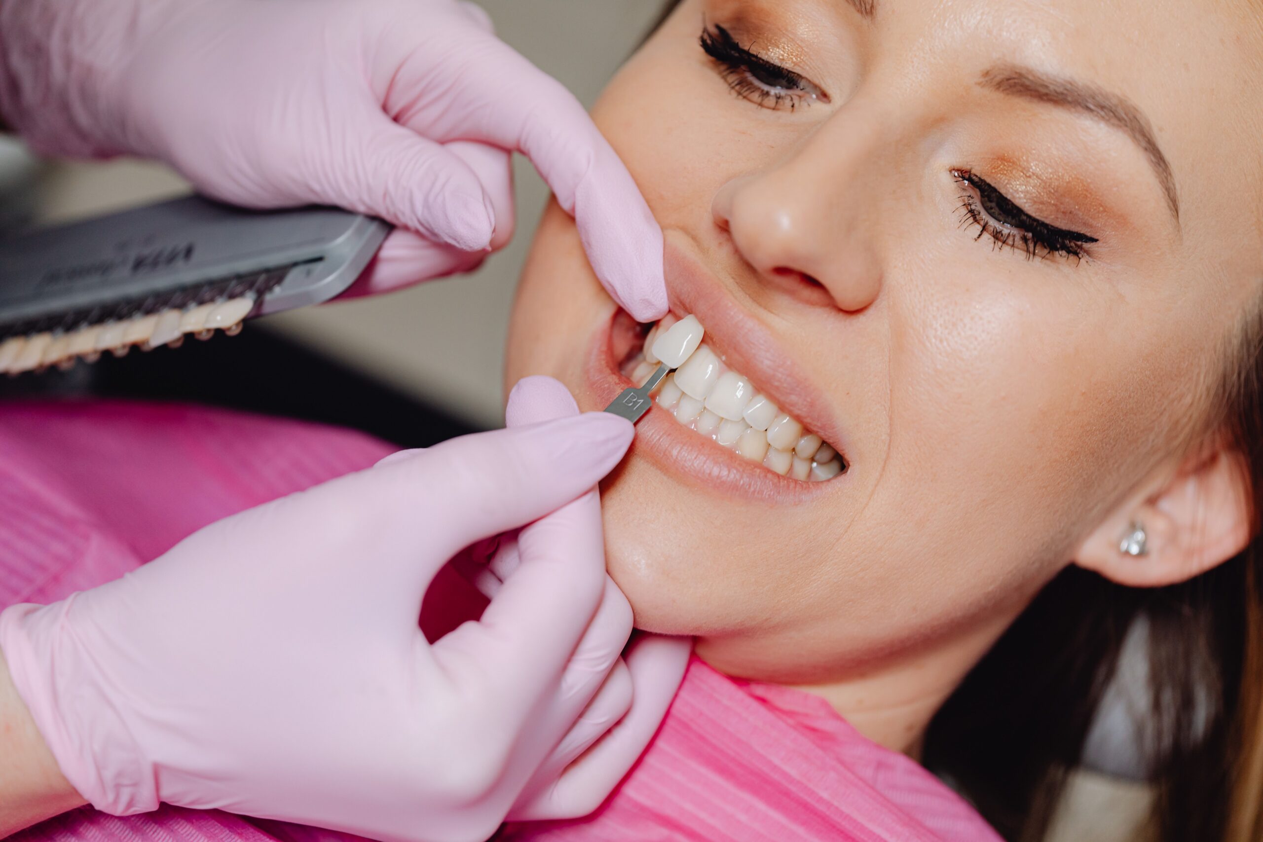 Veneers consultation at Paradise Dental Studio - Fort Lauderdale, FL
